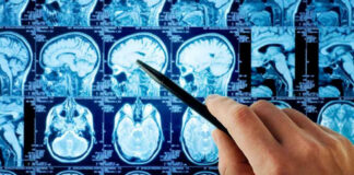 Hand pointing at brain scan images on screen.